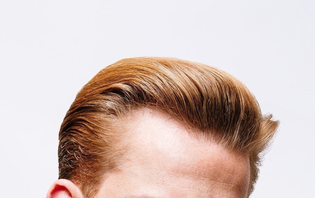 Medical cannabis and CBD products for hair loss.